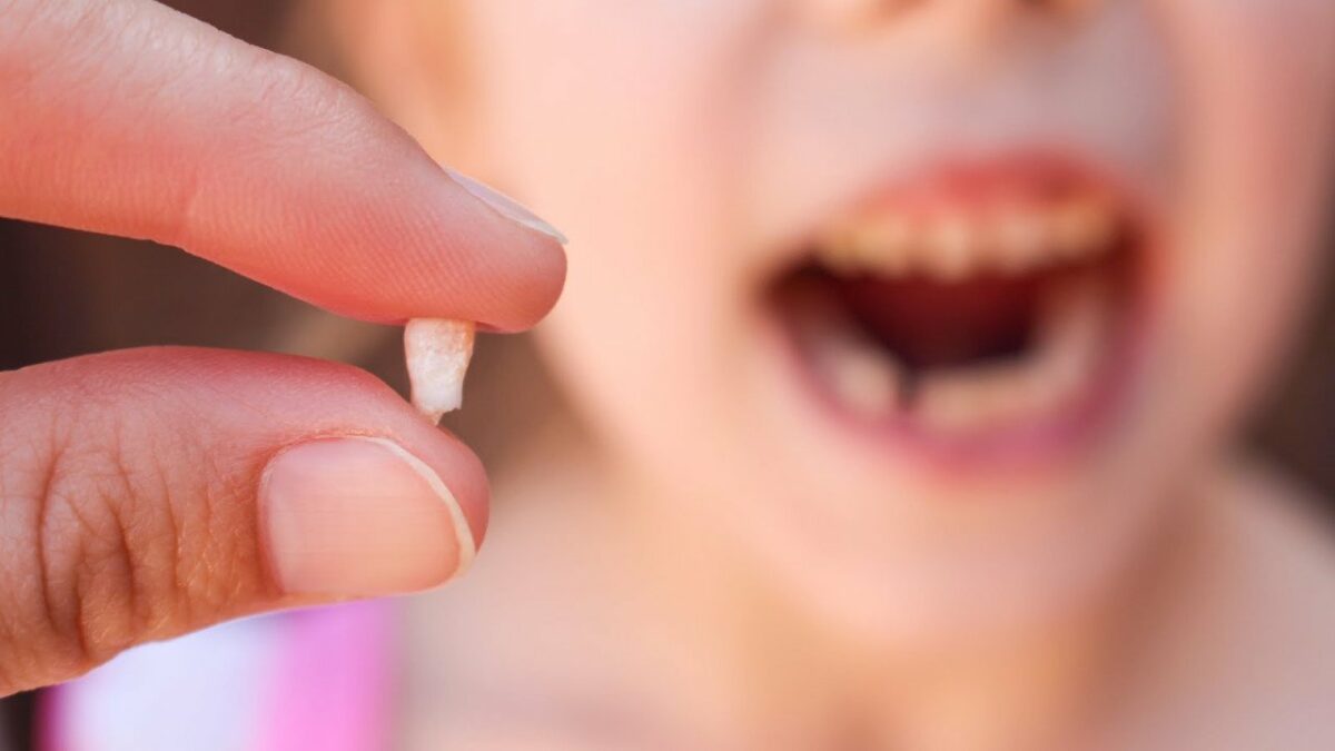 Comment Faire Tomber Sa Dent De Lait Sans Avoir Mal