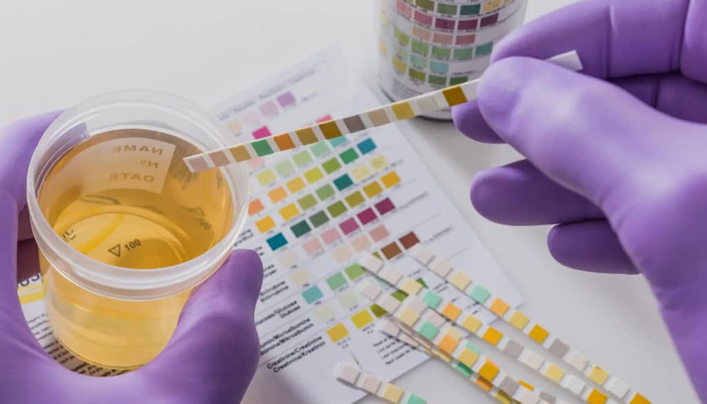examen cytobactériologique des urines