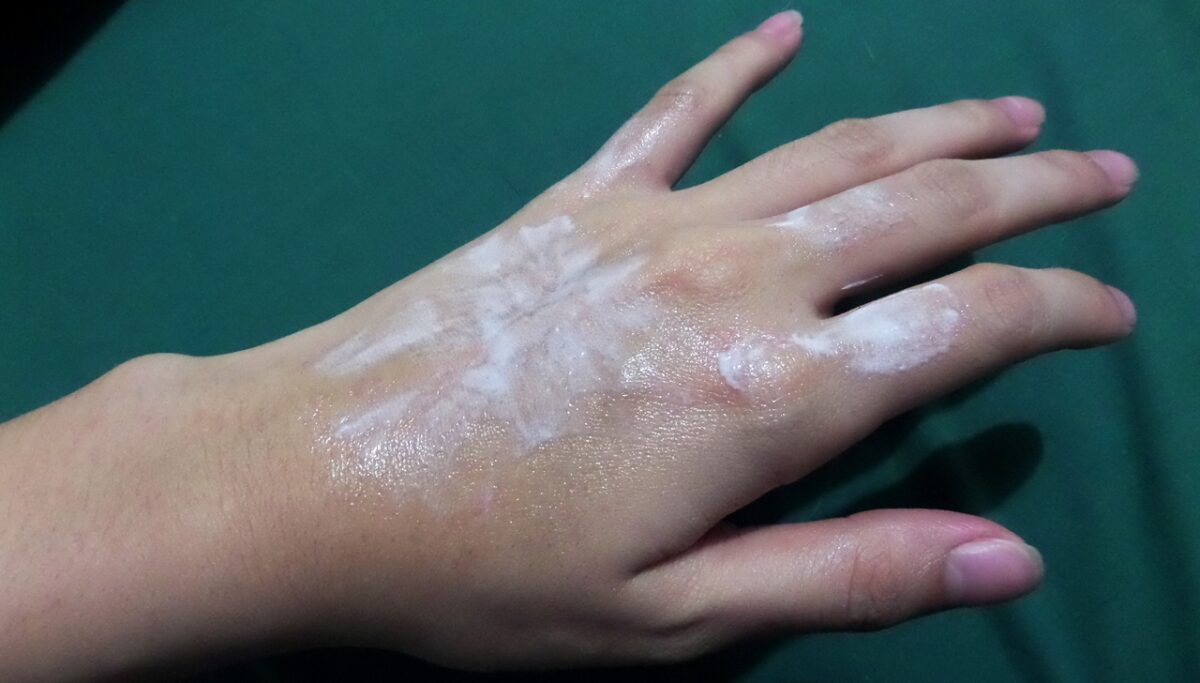 Comment enlever de la glue/colle forte sur les doigts