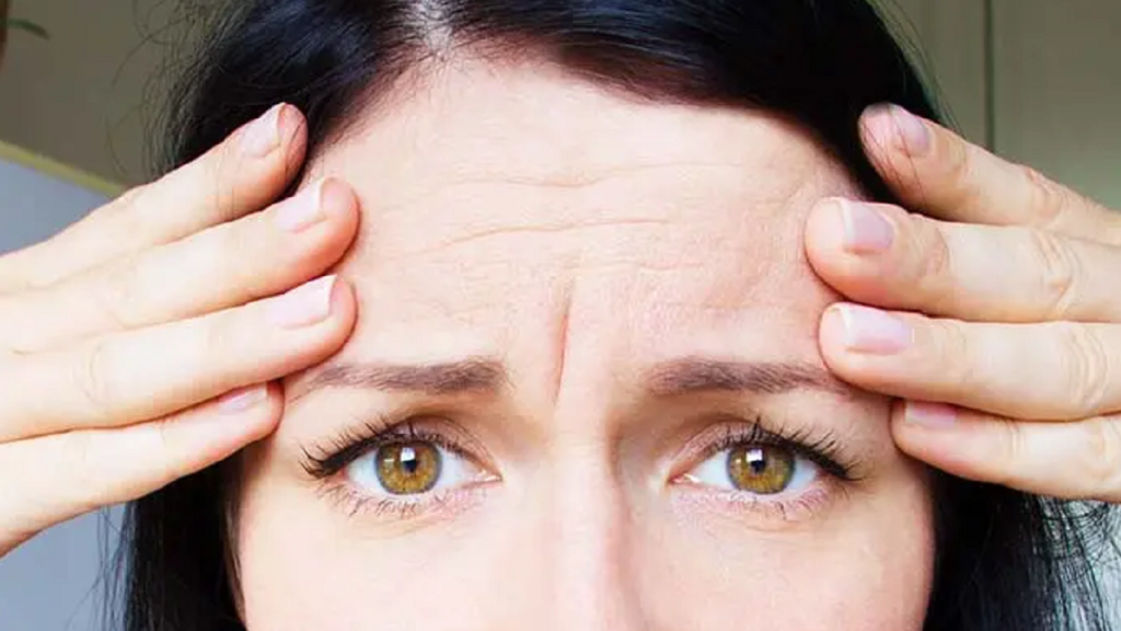 Une femme ayant des rides ayant besoin de botox