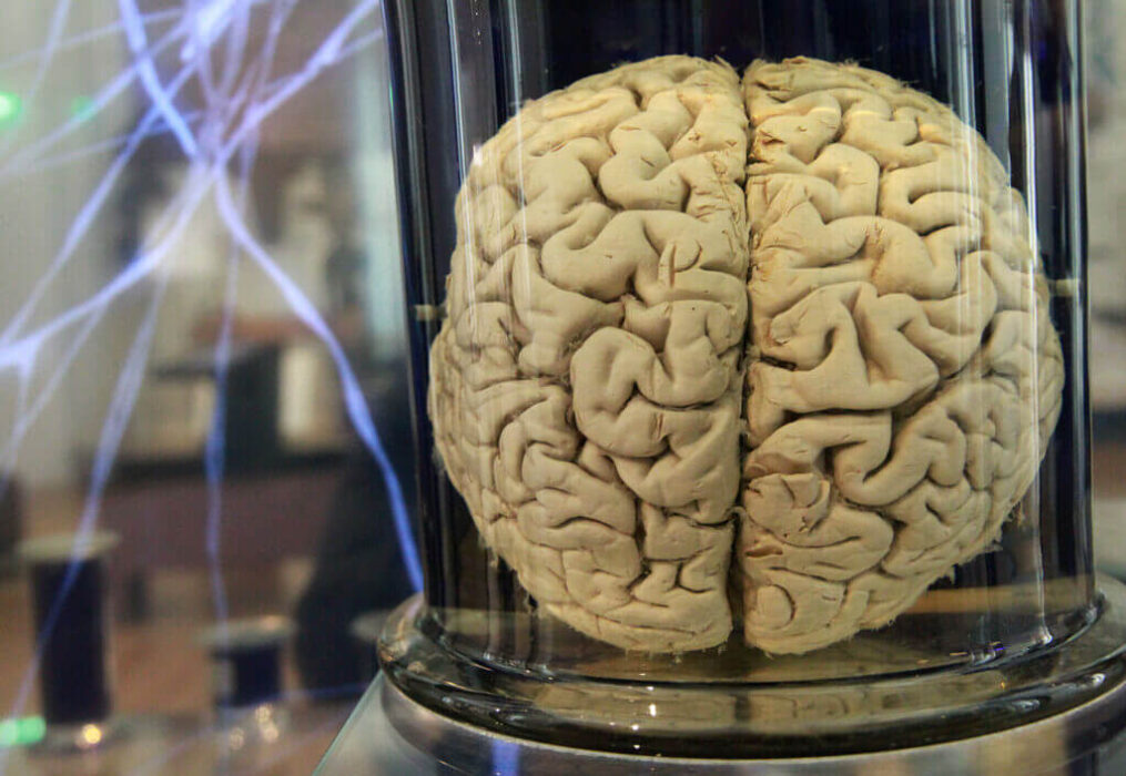 Un cerveau humain