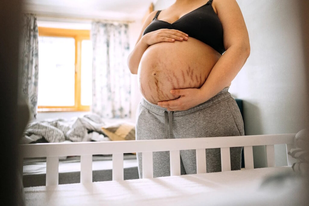 femme enceinte vergetures