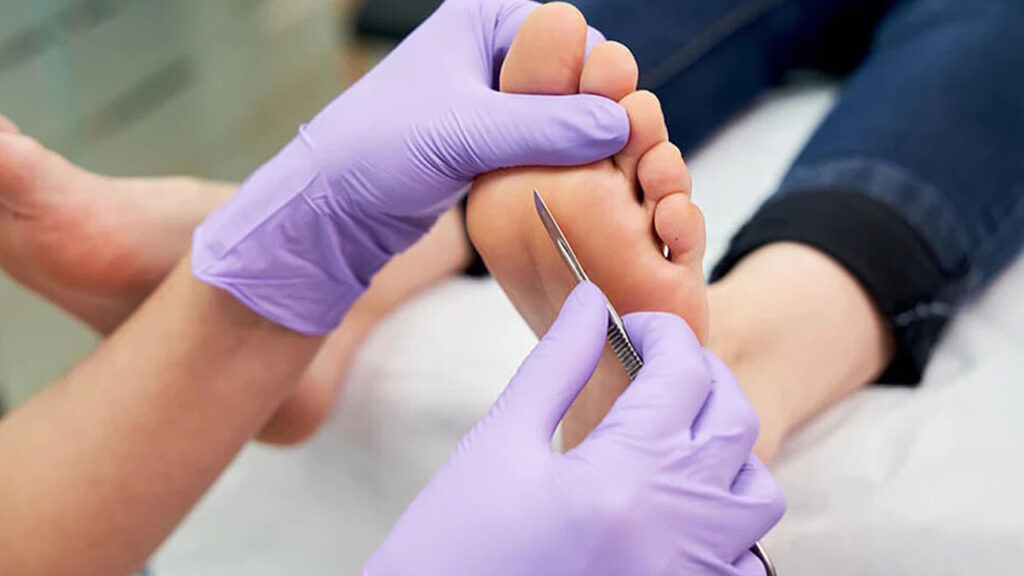 soin des pieds