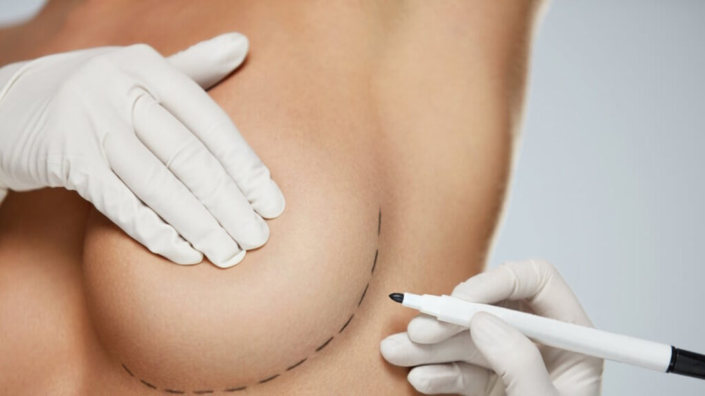 Les avancées en chirurgie mammaire