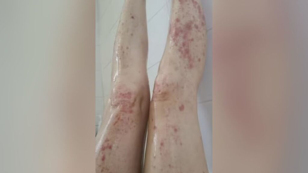 fast fashion allergie Cath Matar