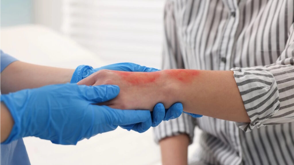 Les effets anti-inflammatoires et apaisants