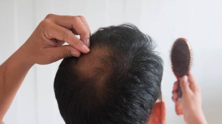 causes et solutions à la perte de cheveux