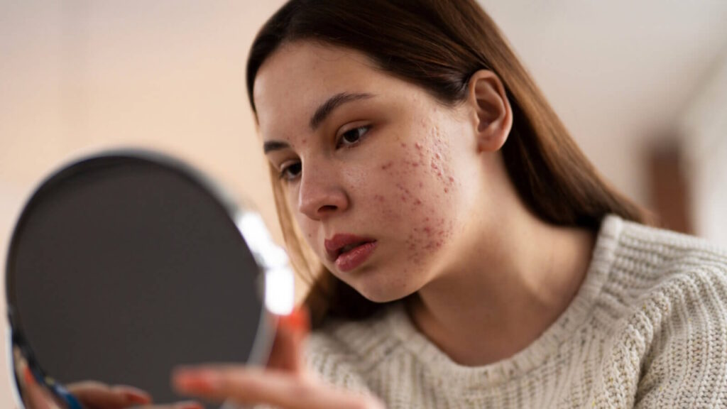 La peau et les émotions quand le stress se lit sur le visage