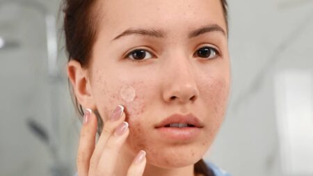patch boutons acne visage