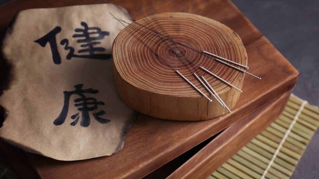aiguilles acupuncture
