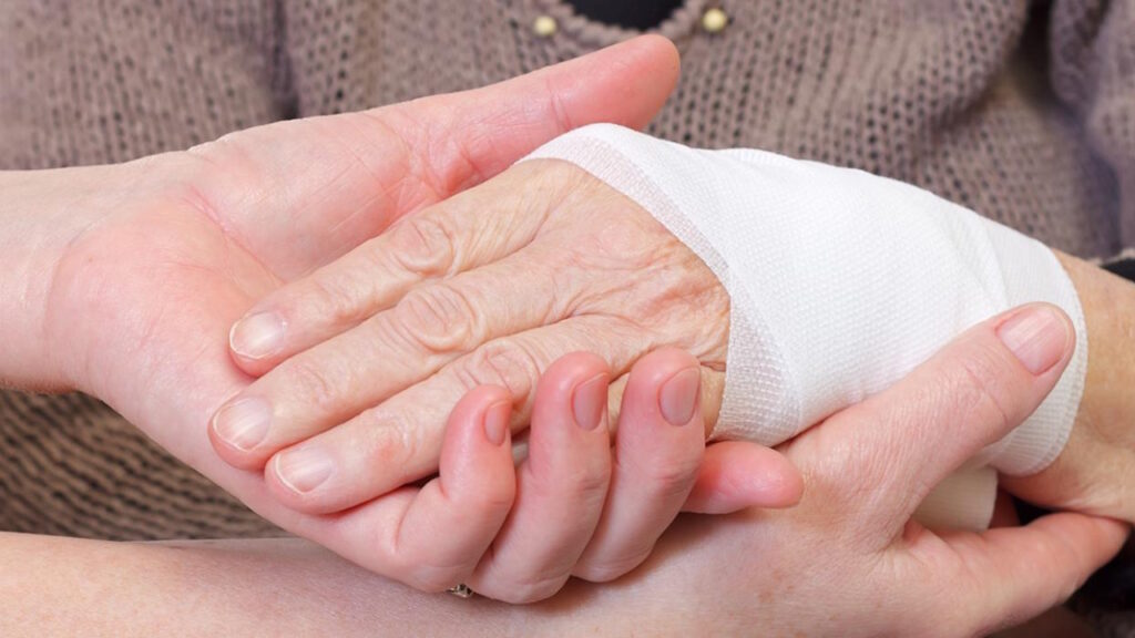 Les capacités de régénération partielle