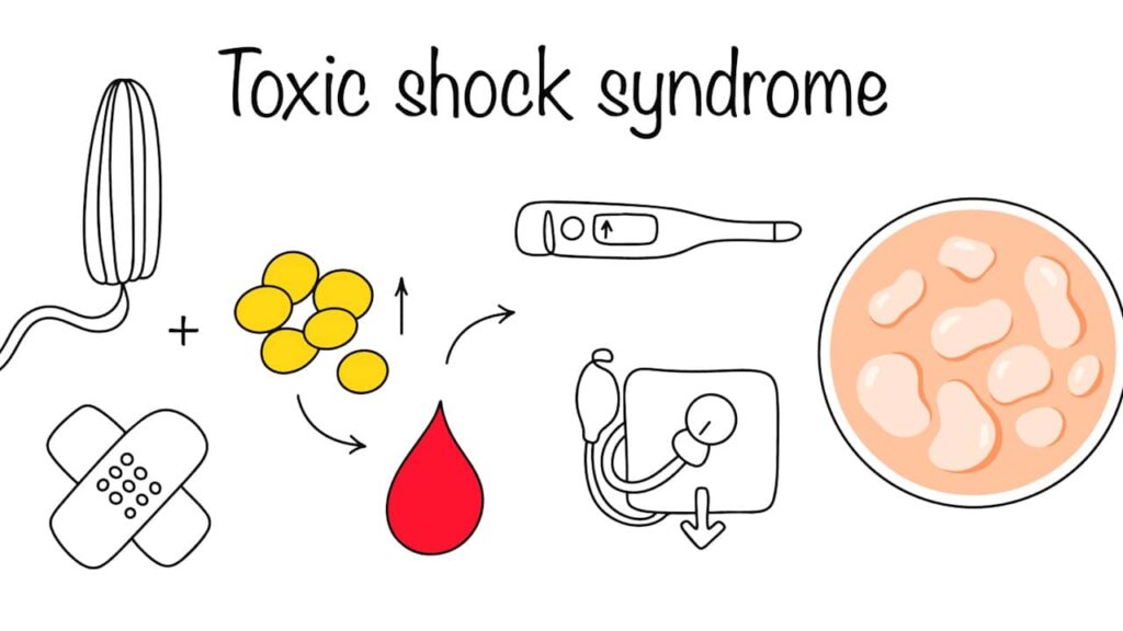 syndrome choc toxique tampon sang