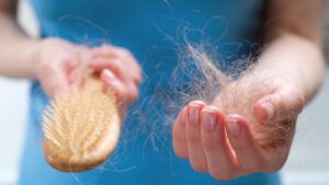 Chute de cheveux