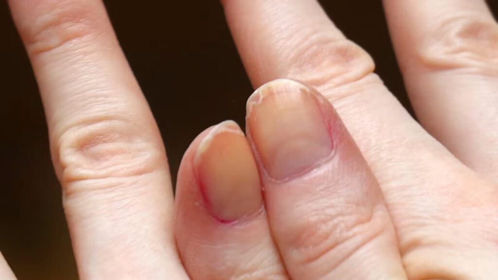 Des cheveux et des ongles fragiles peuvent attirer l’attention