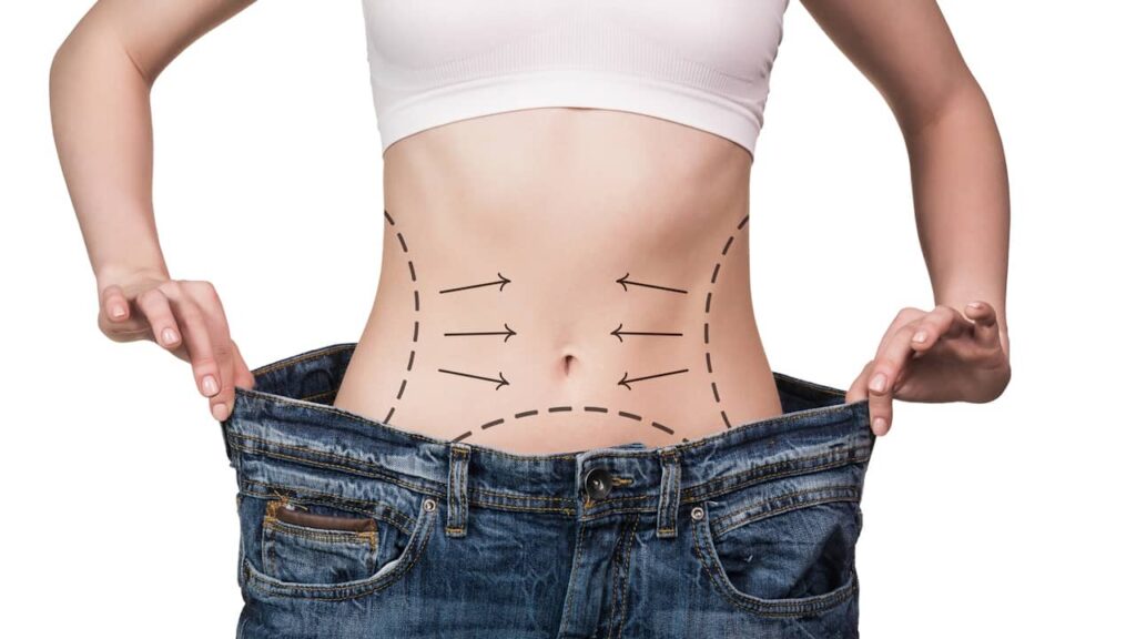 chirurgie esthetique